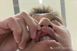 高迪赛后共缝九针：昨天蛮疼今天又是一条好汉，不想错过踢申花